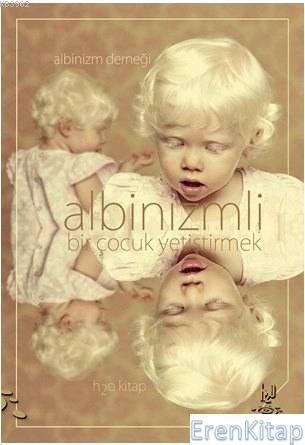 Albinizmli Bir Çocuk Yetiştirmek :  Albinizm Derneği